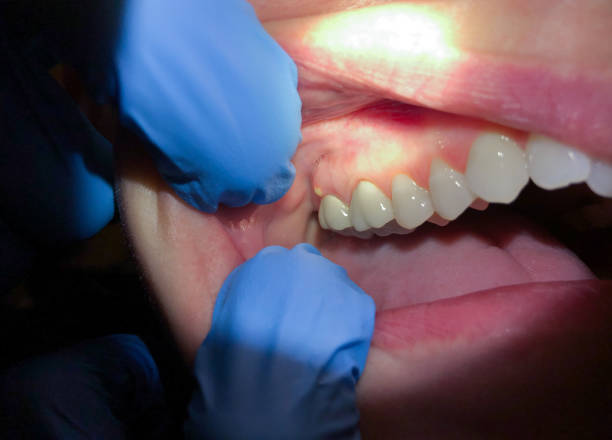 Best Weekend Emergency Dentist in Sharon, PA